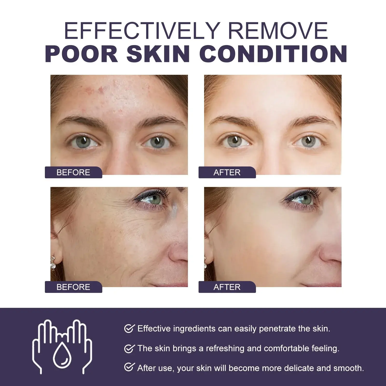 Vitamin B3 Serum - Brightening, Wrinkle Reduction & Hydration 9 HOA05 A017 30 WH1 009