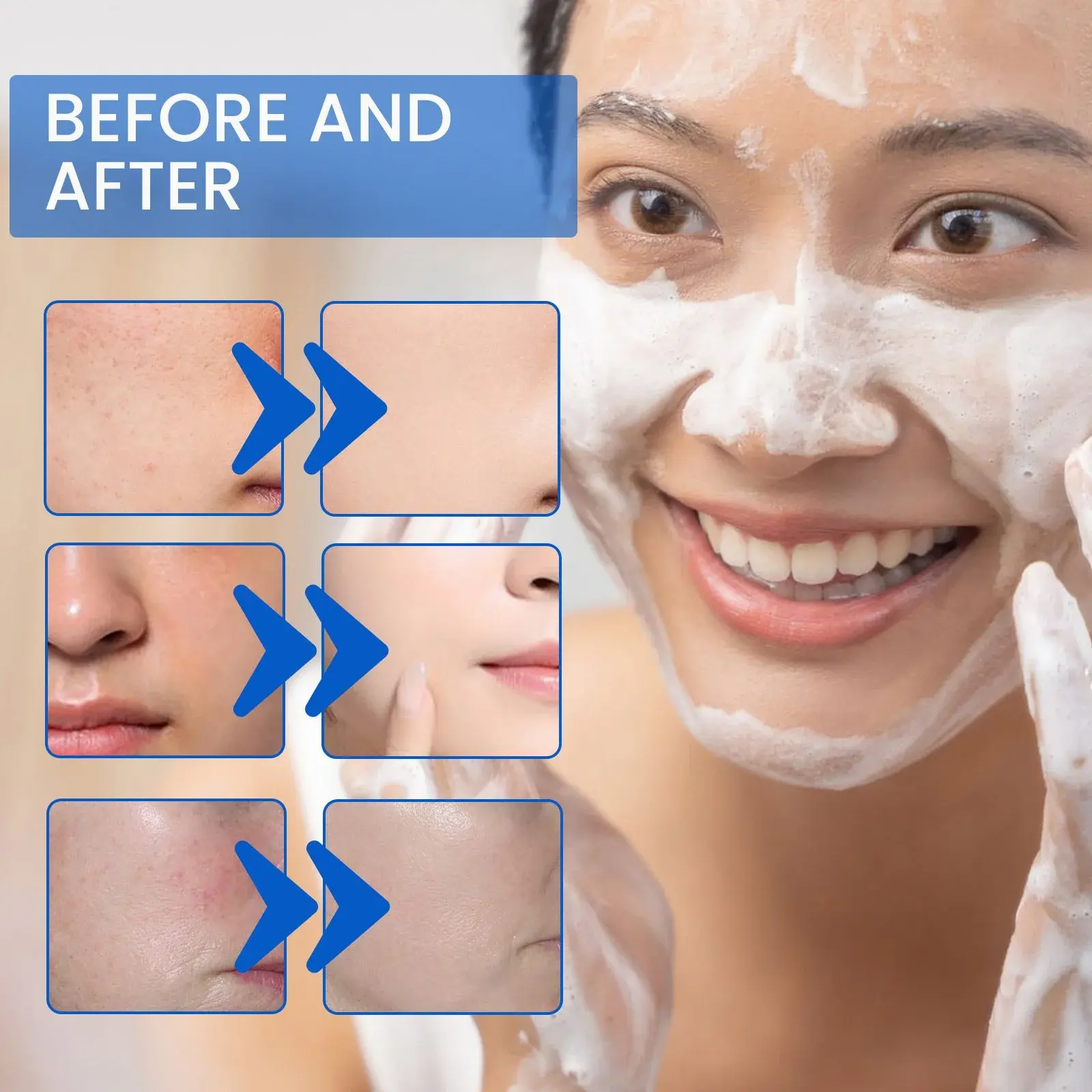 Blueberry Cleanser Foam - Gentle Face Cleanser for Blackheads 9 HOA05 A019 100 BU1 010