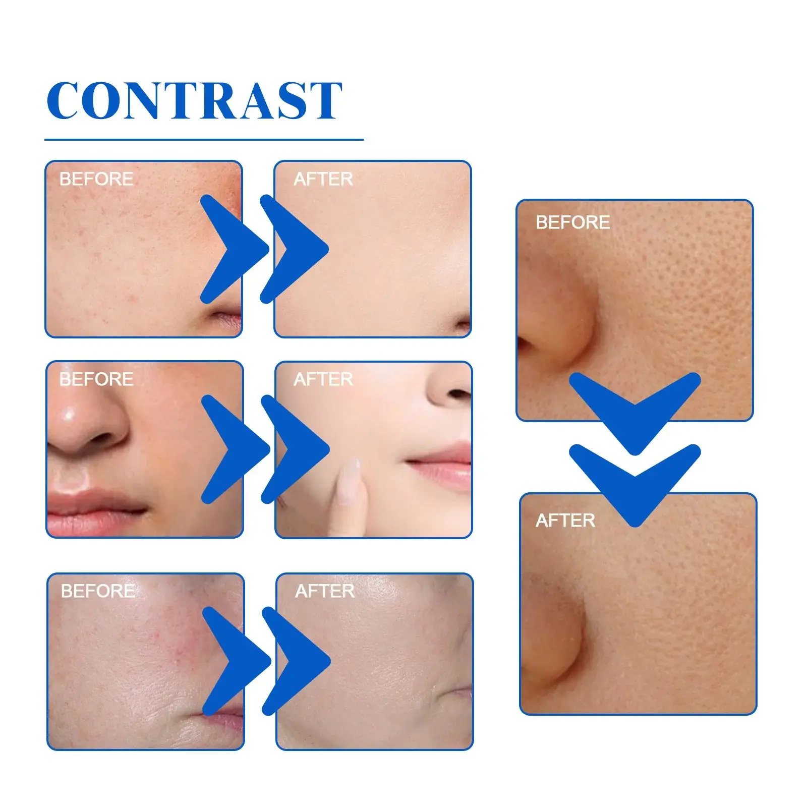 Blueberry Moisturizing Toner for Hydrated & Bright Skin 9 HOA05 A019 100 BU2 010