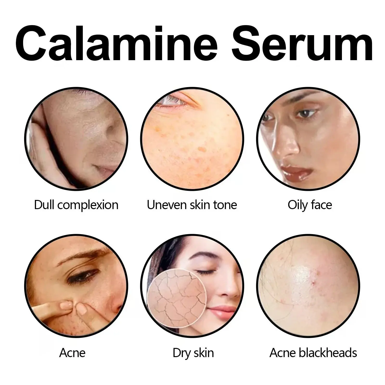 Calamine Serum for Dry Skin & Acne - Hydrating & Plumping Formula 8 HOA05 A022 30 GD1 008