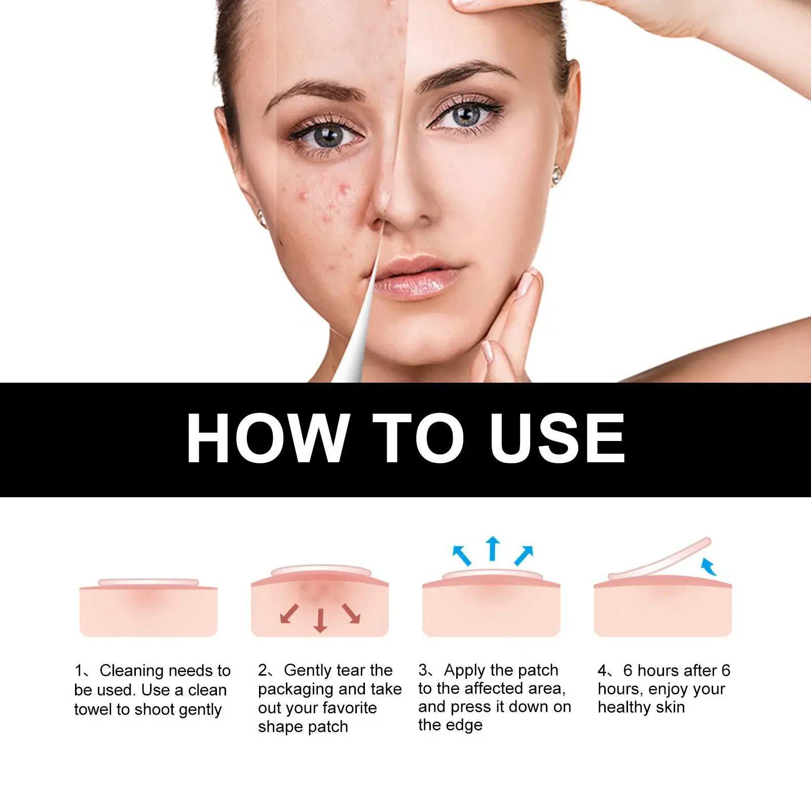 Cute Black Acne Patches for Pimple Treatment - Hoygi 4 HOA05 A027 108 BK1 005