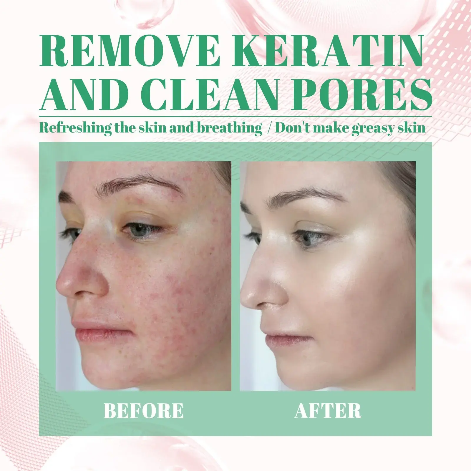 Tea Tree Cleansing Clay Mask Stick - Deep Pore & Acne Care 8 HOA05 A033 40 GN1 008