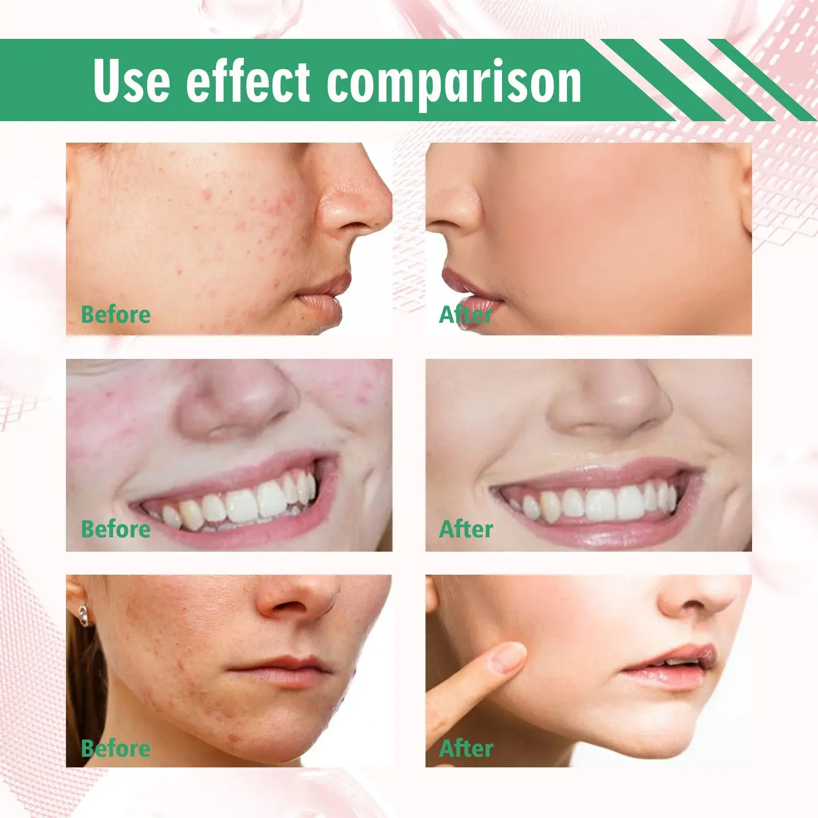 Tea Tree Cleansing Clay Mask Stick - Deep Pore & Acne Care 9 HOA05 A033 40 GN1 009