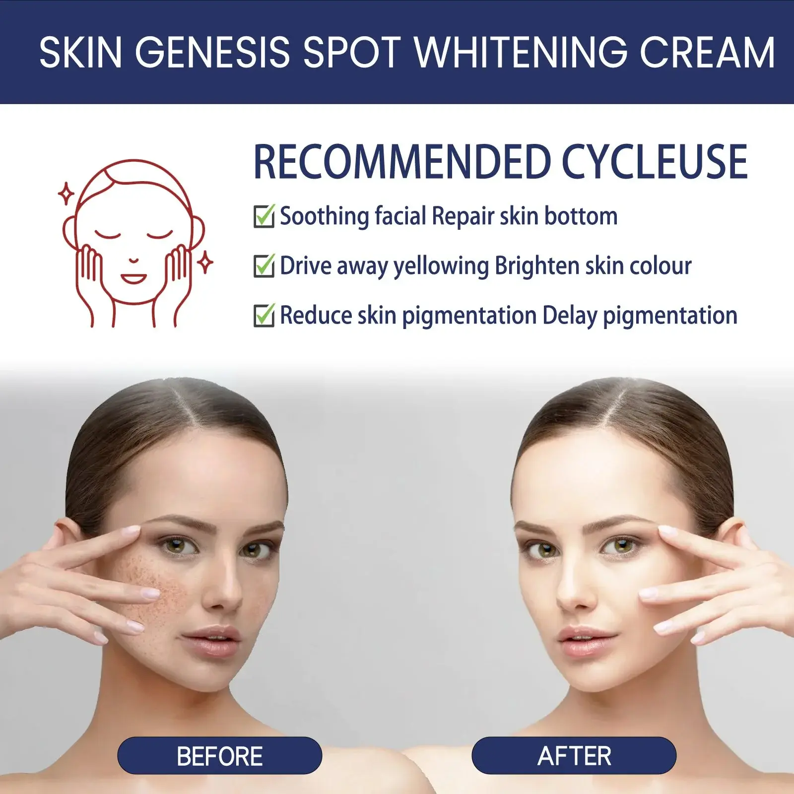 Spot Whitening Cream & Brightening Moisturizer - Skin Genesis - Hoygi 5 HOA05 A034 100 WH1 006