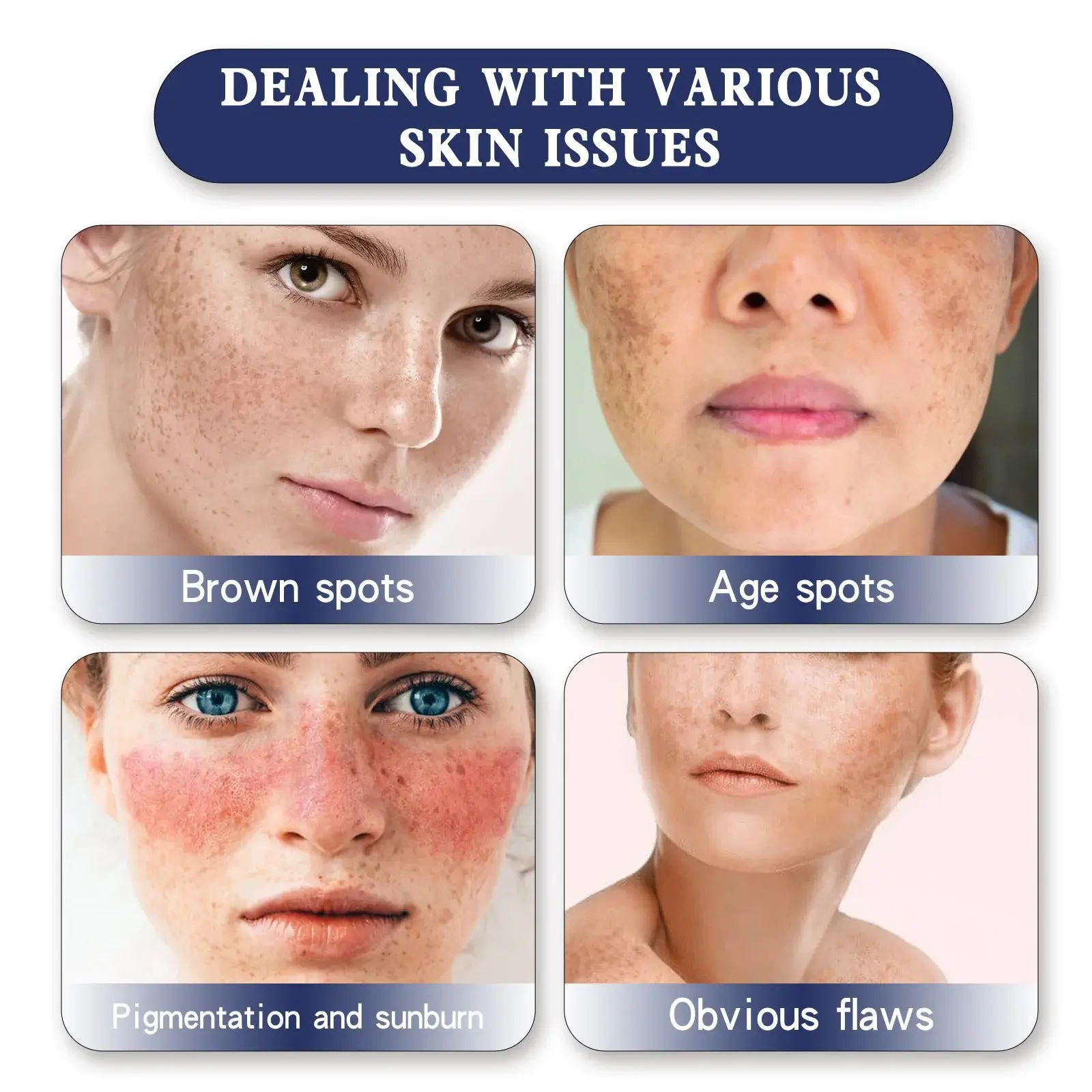 Spot Whitening Cream & Brightening Moisturizer - Skin Genesis - Hoygi 6 HOA05 A034 100 WH1 007