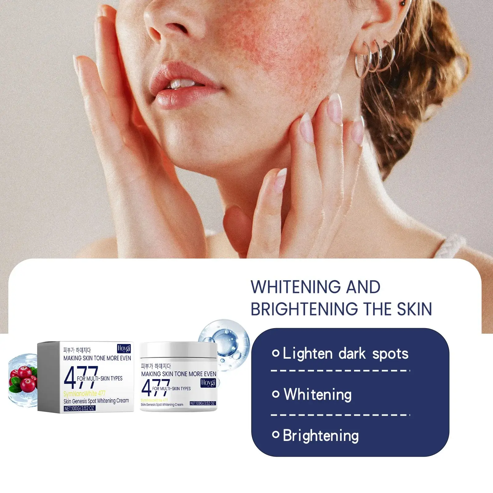 Spot Whitening Cream & Brightening Moisturizer - Skin Genesis - Hoygi 7 HOA05 A034 100 WH1 008