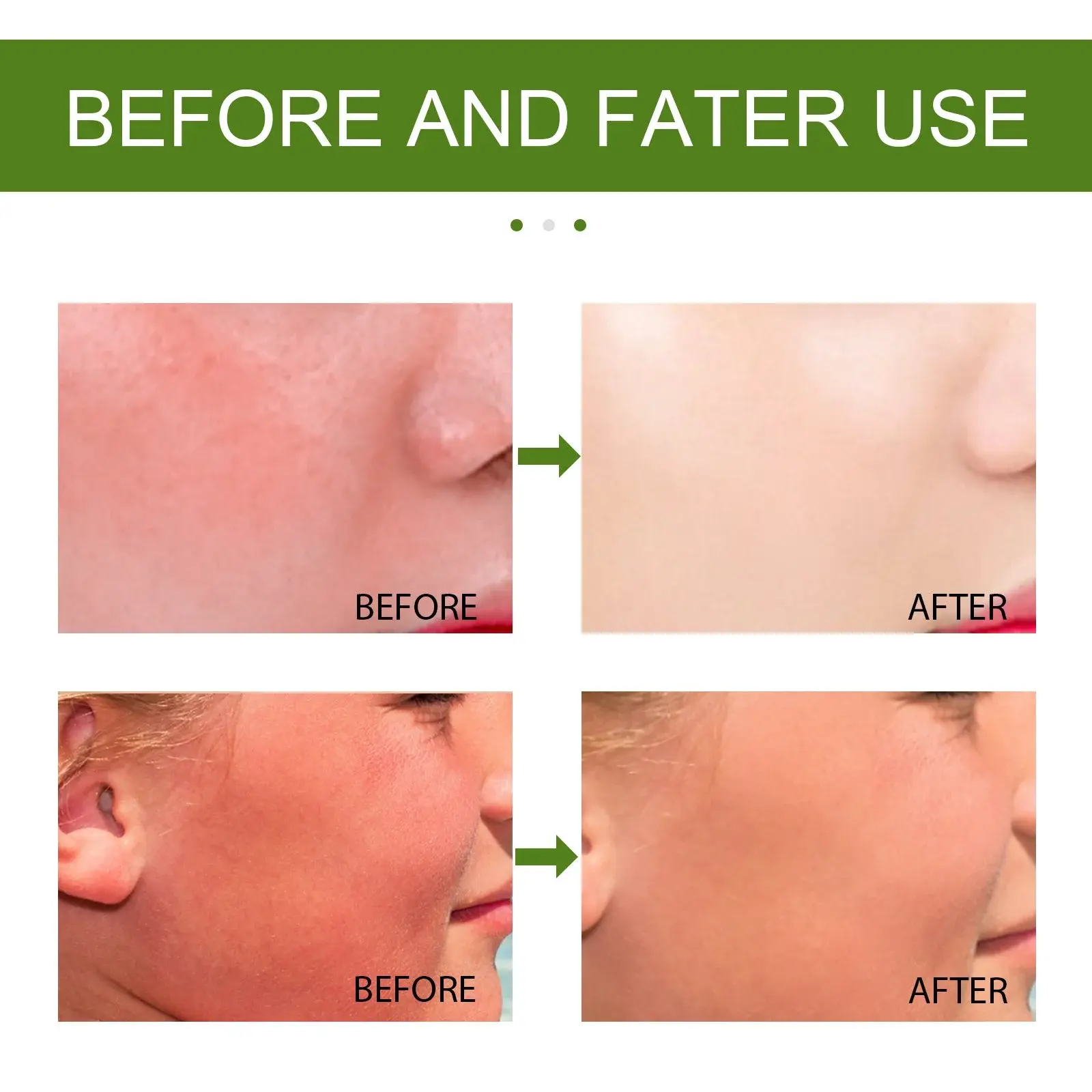 Fresh Aloe Vera Gel for Face - Soothing & Hydrating After Sun Care 9 HOA05 A037 60 GN1 009