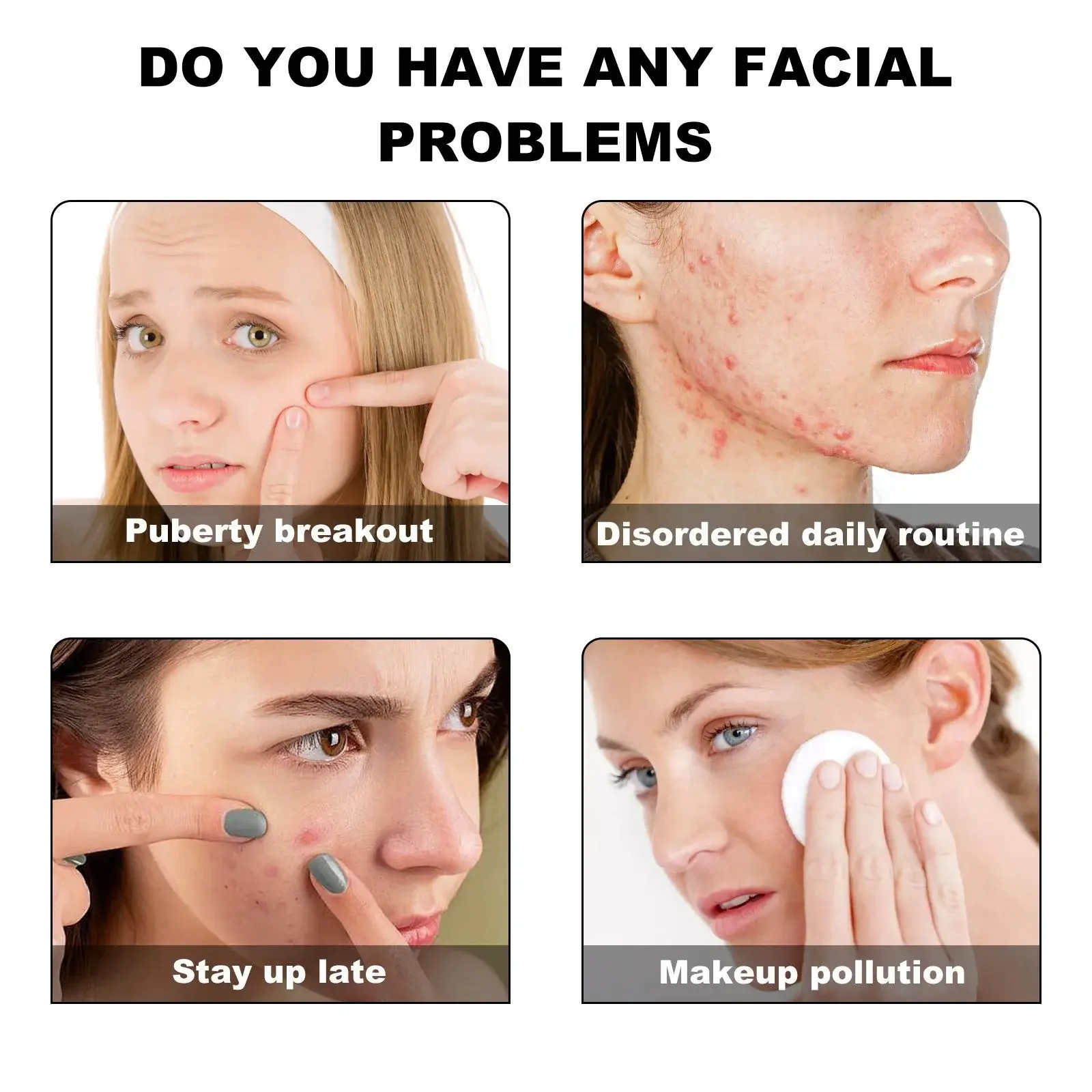 Colorful Acne Patches for Skin Repair and Smoothing 6 HOA05 A057 140 VT1 007