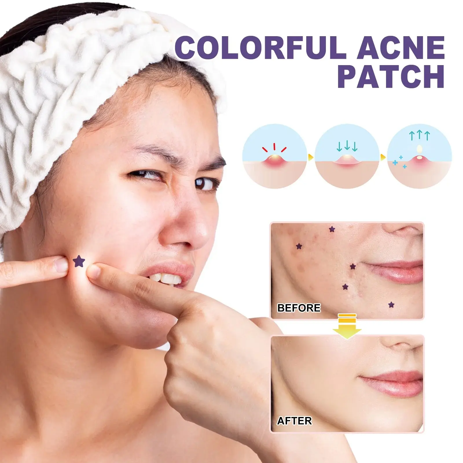 Colorful Acne Patches for Skin Repair and Smoothing 7 HOA05 A057 140 VT1 008
