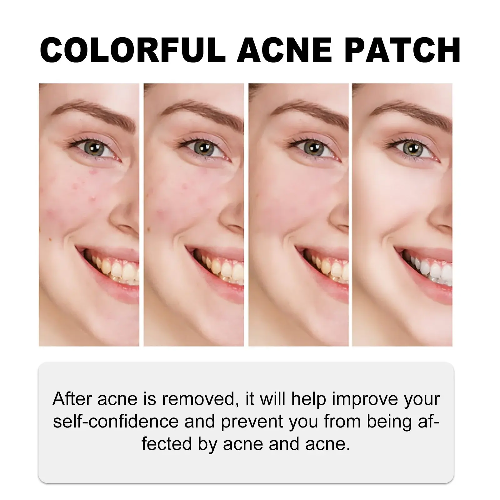 Colorful Acne Patches for Skin Repair and Smoothing 9 HOA05 A057 140 VT1 010