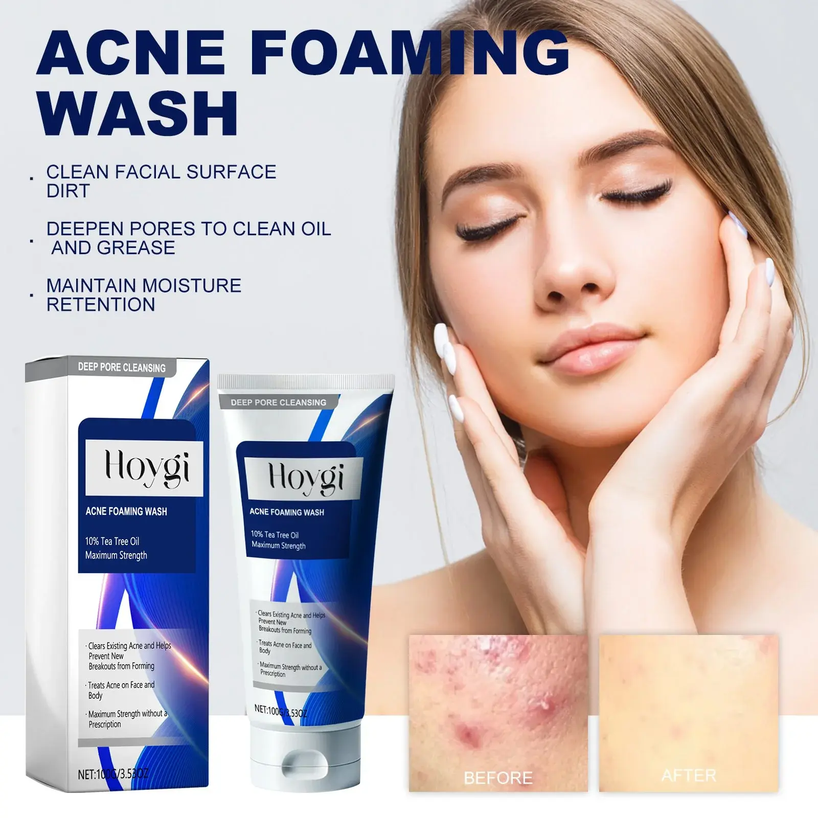 Acne Foaming Wash - Gentle Oil Control & Hydrating Cleanser 2 HOA05 A061 100 WH1 003