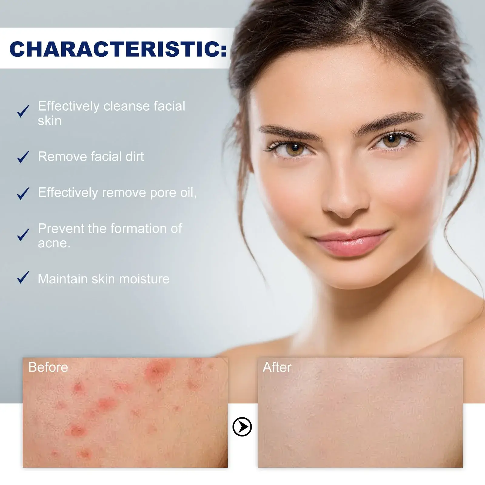 Acne Foaming Wash - Gentle Oil Control & Hydrating Cleanser 5 HOA05 A061 100 WH1 006
