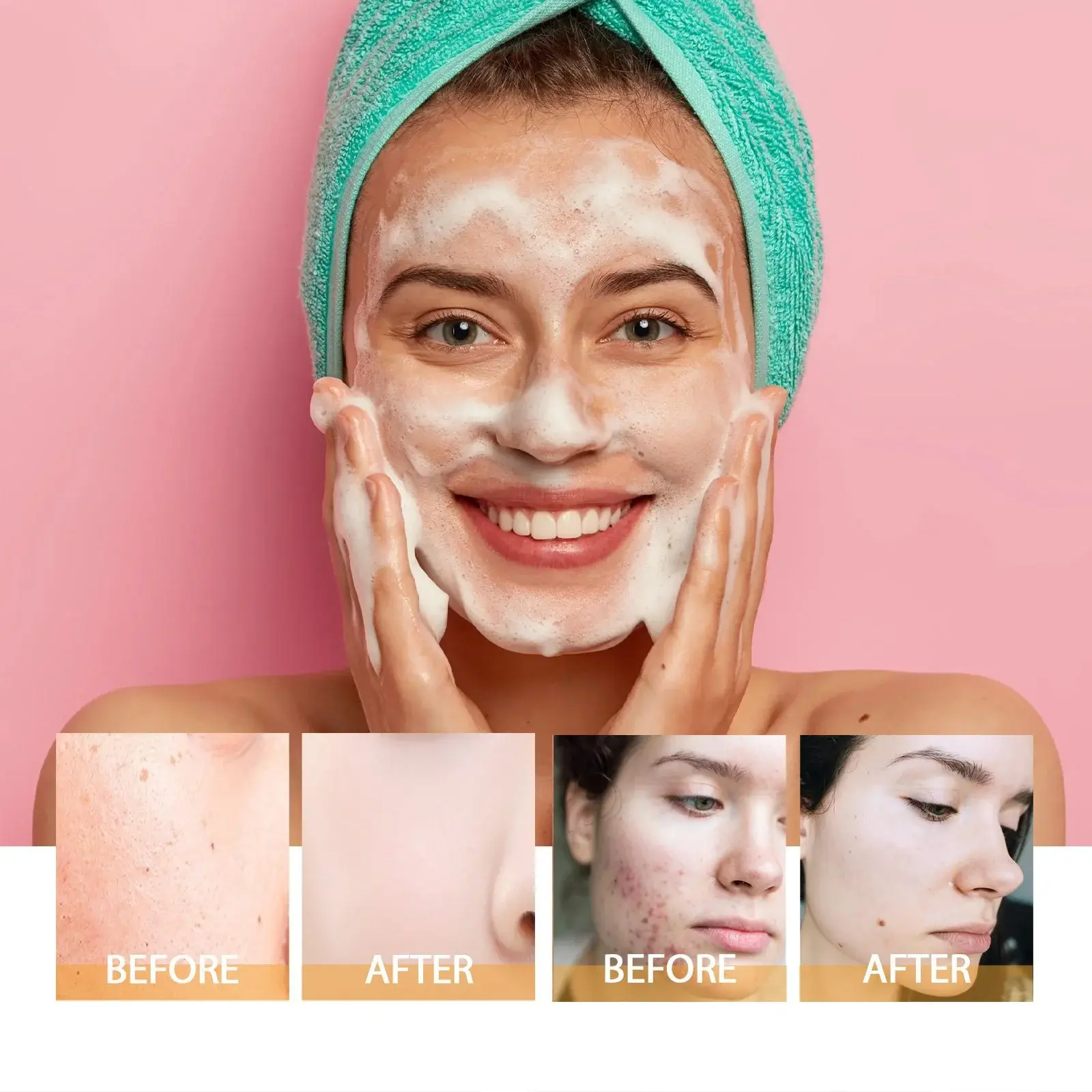 Brightening Facial Cleanser Deep Cleansing for Acne-Prone Skin - Hoygi 9 HOA05 A094 100 OG1 010