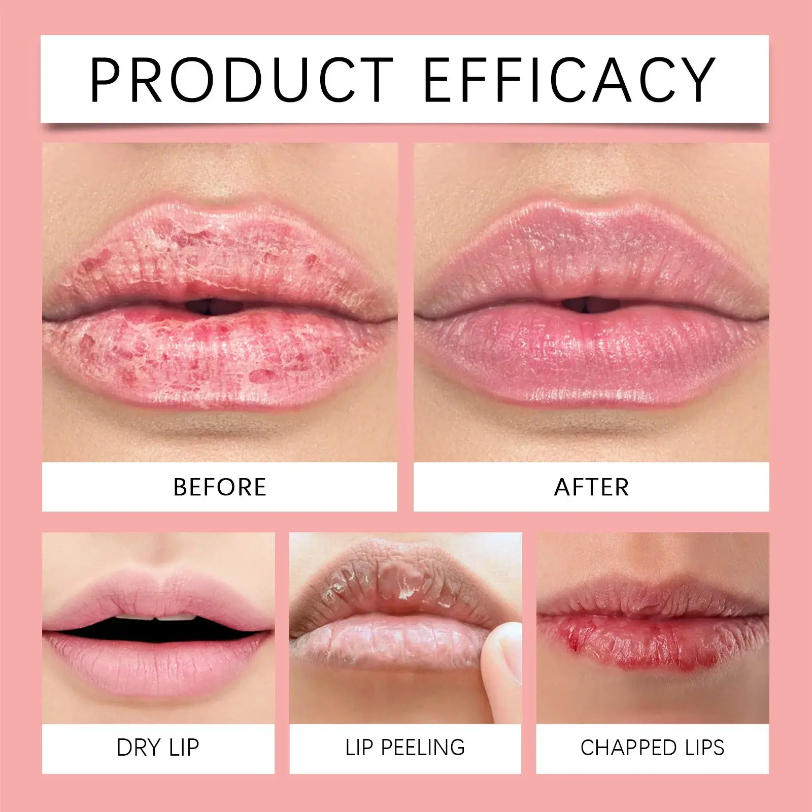 Watermelon Lip Mask for Dry Lips Moisturizing Treatment - Hoygi 9 HOA05 A111 6 WH4 010