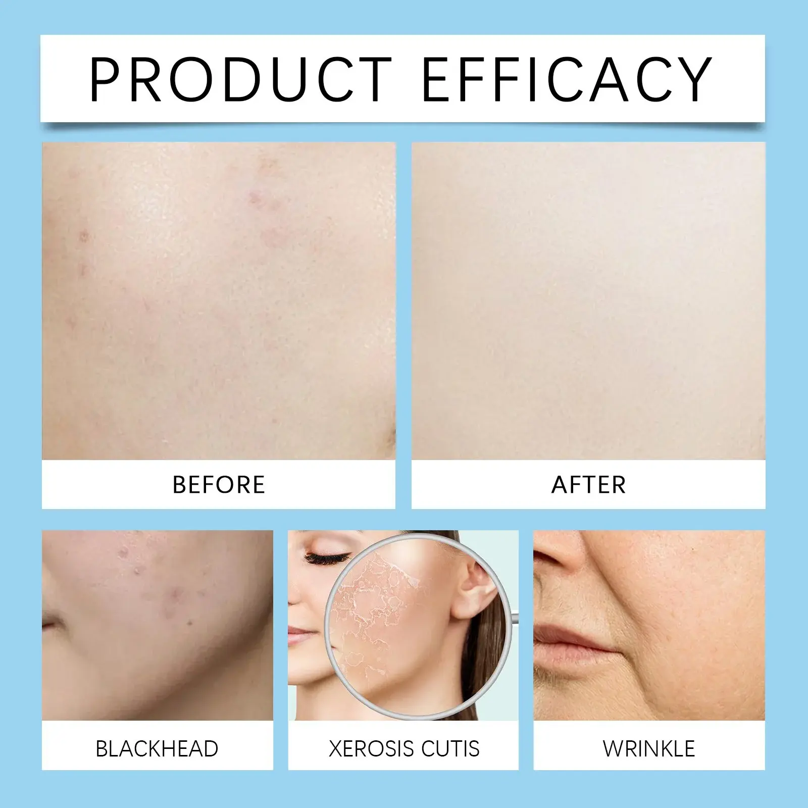 2% Salicylic Acid Serum - Exfoliating & Pore Refining Formula 9 HOA05 A112 60 BU1 009
