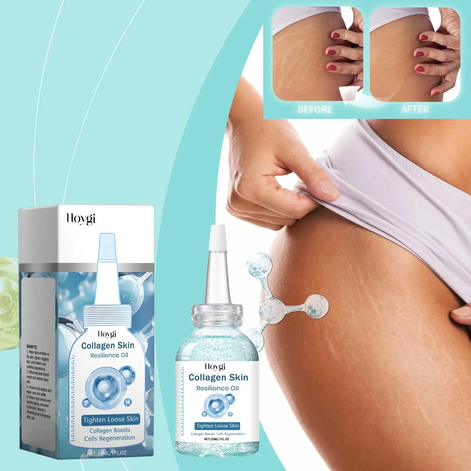 Pregnancy Care Oil for Stretch Marks & Scars - Skin Nourishing Formula 2 HOA05 A135 32 BU1 002