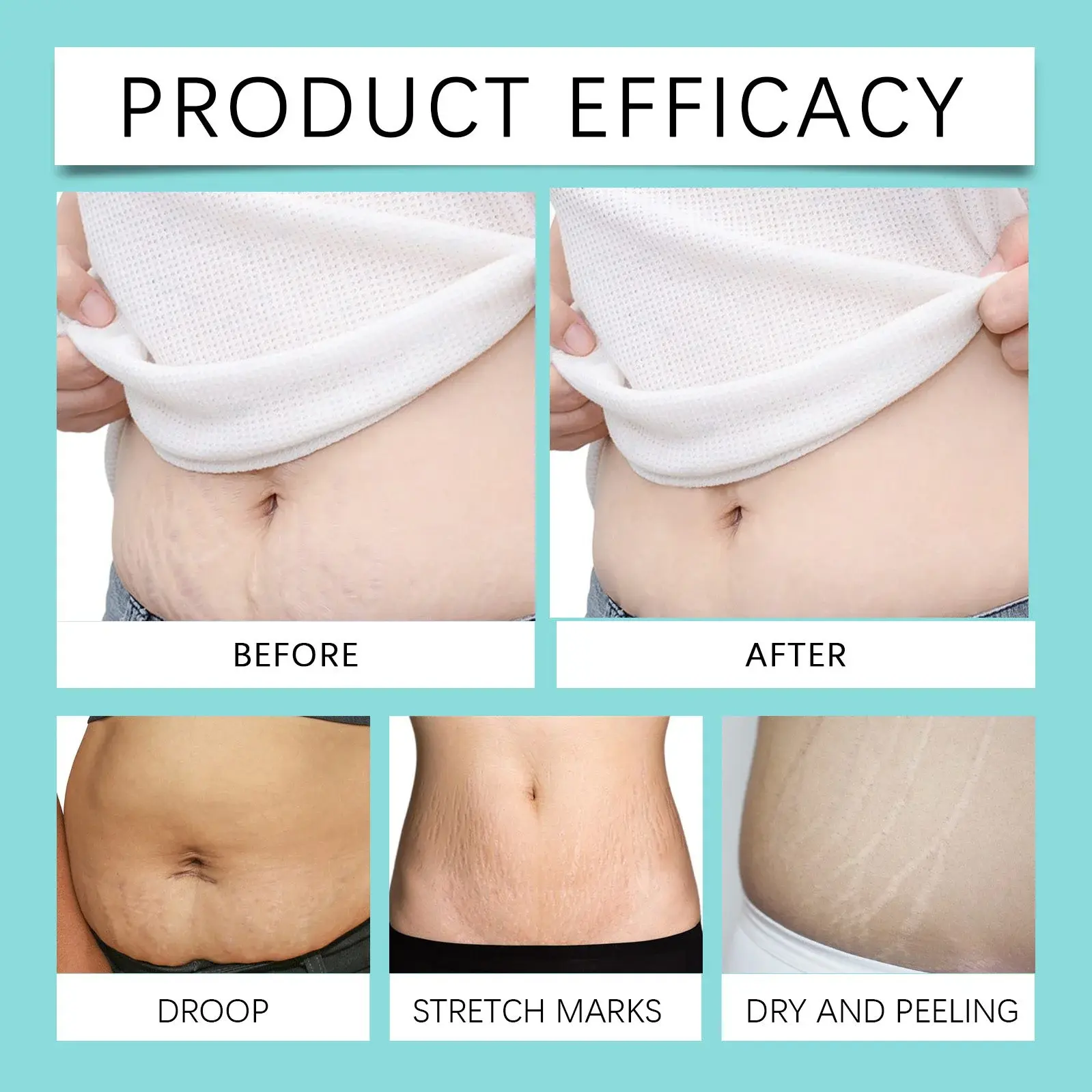 Pregnancy Care Oil for Stretch Marks & Scars - Skin Nourishing Formula 9 HOA05 A135 32 BU1 009