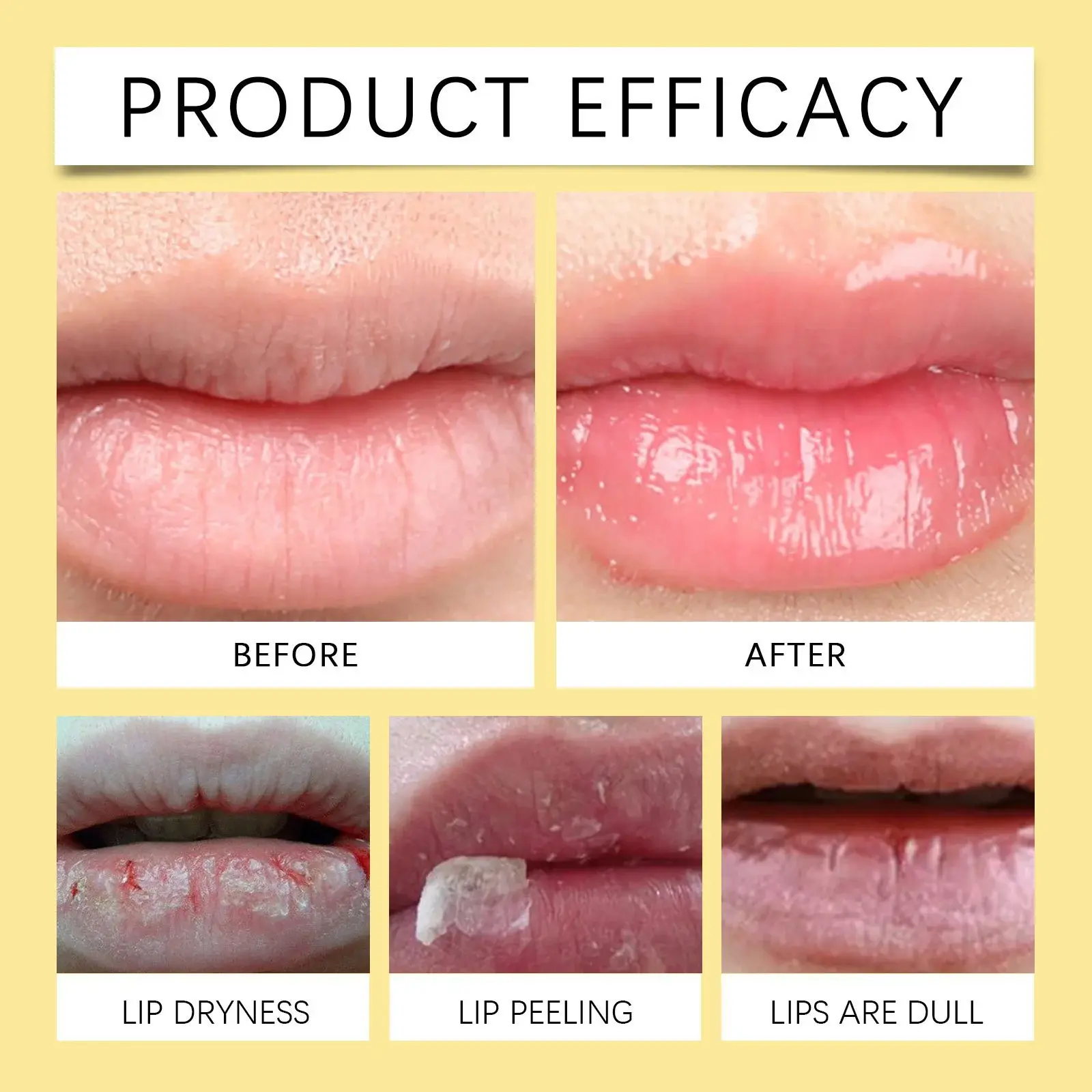 Honey Nourishing Lip Balm - Deeply Moisturizing & Dryness Prevention 9 HOA05 A140 15 YE1 009