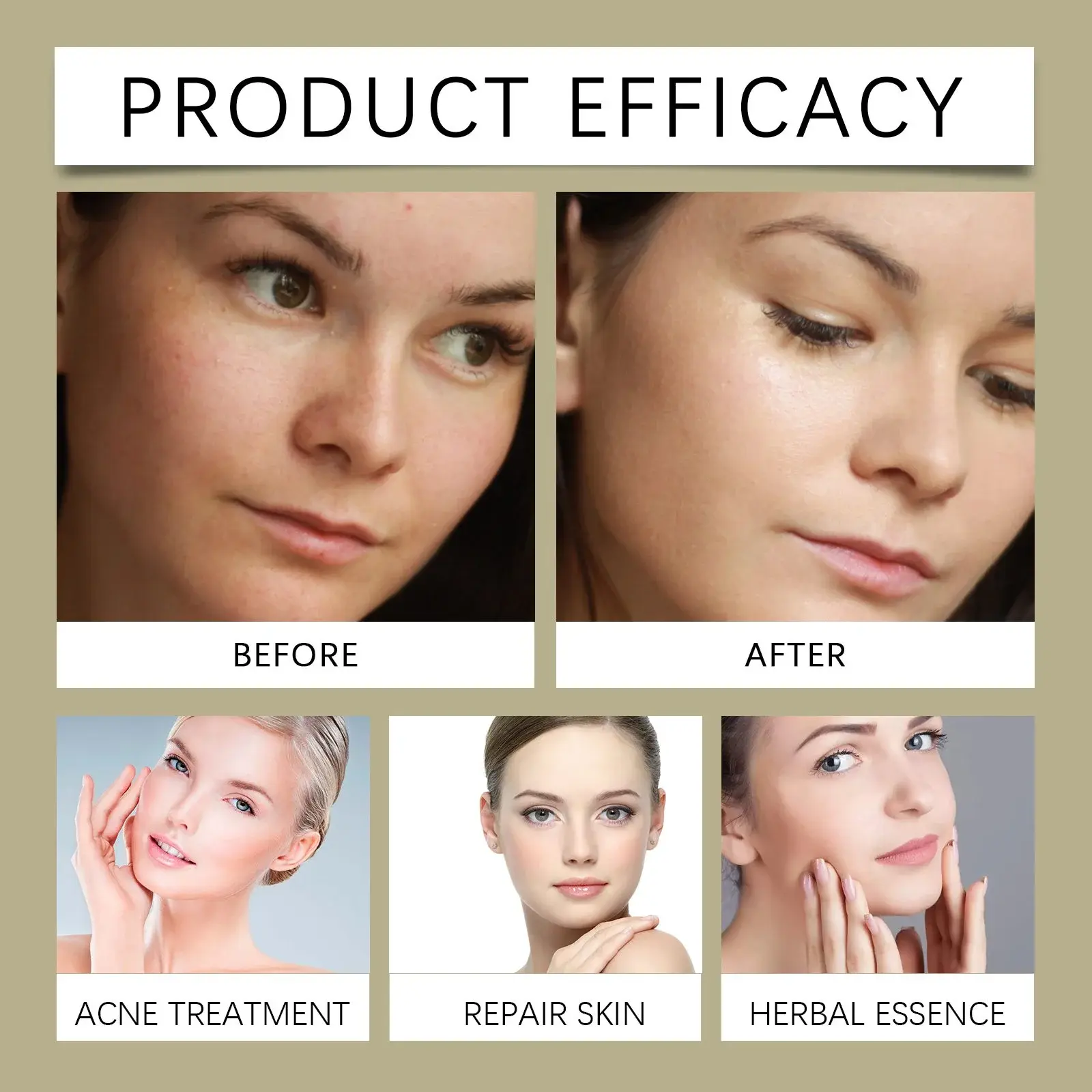 Glycolic Acid Face Toner - Oil Balancing & Skin Repair Formula 9 HOA05 A158 100 WH1 009