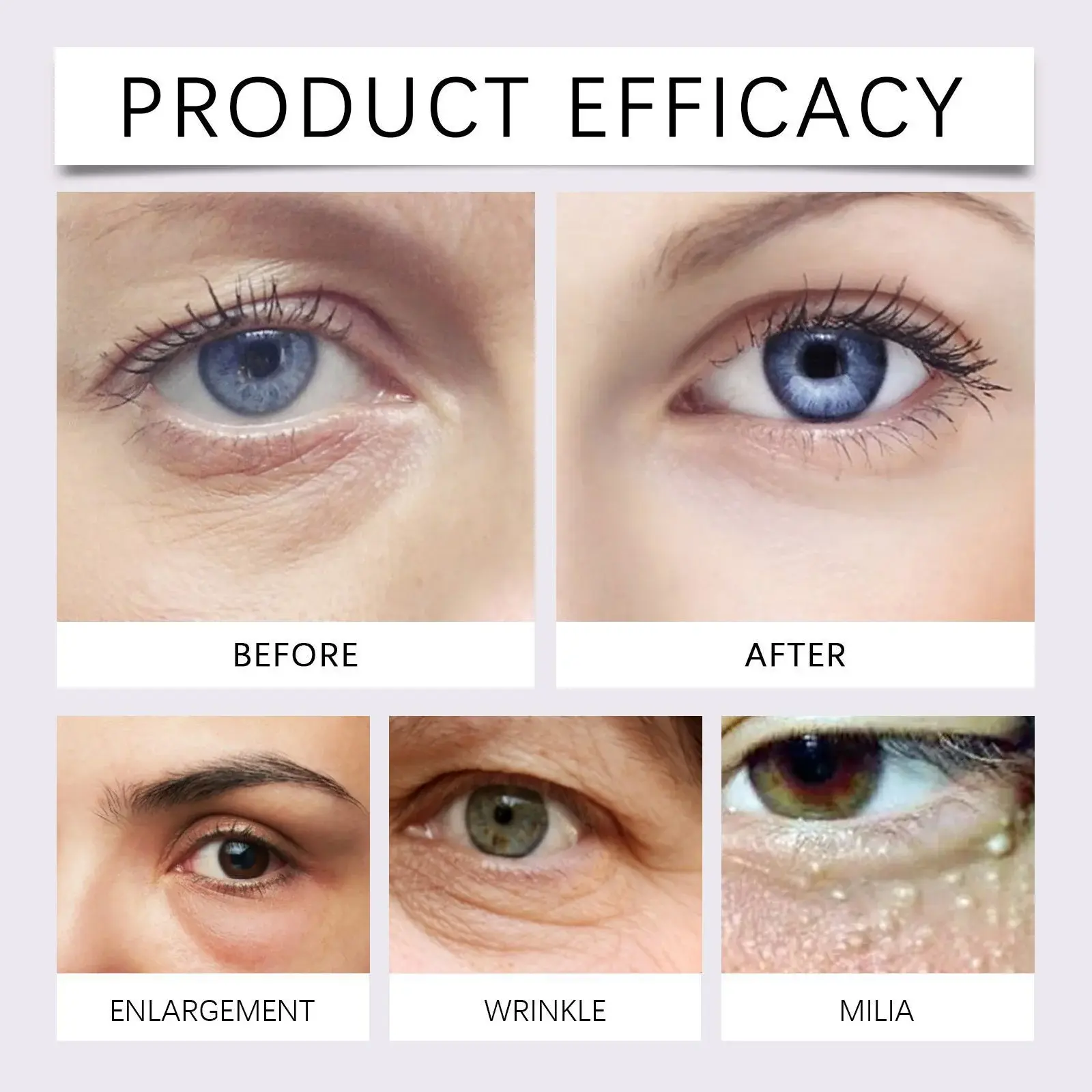 Anti-Wrinkle Eye Cream with Bee Venom & Coffee Extract 9 HOA05 A166 30 YE1 009