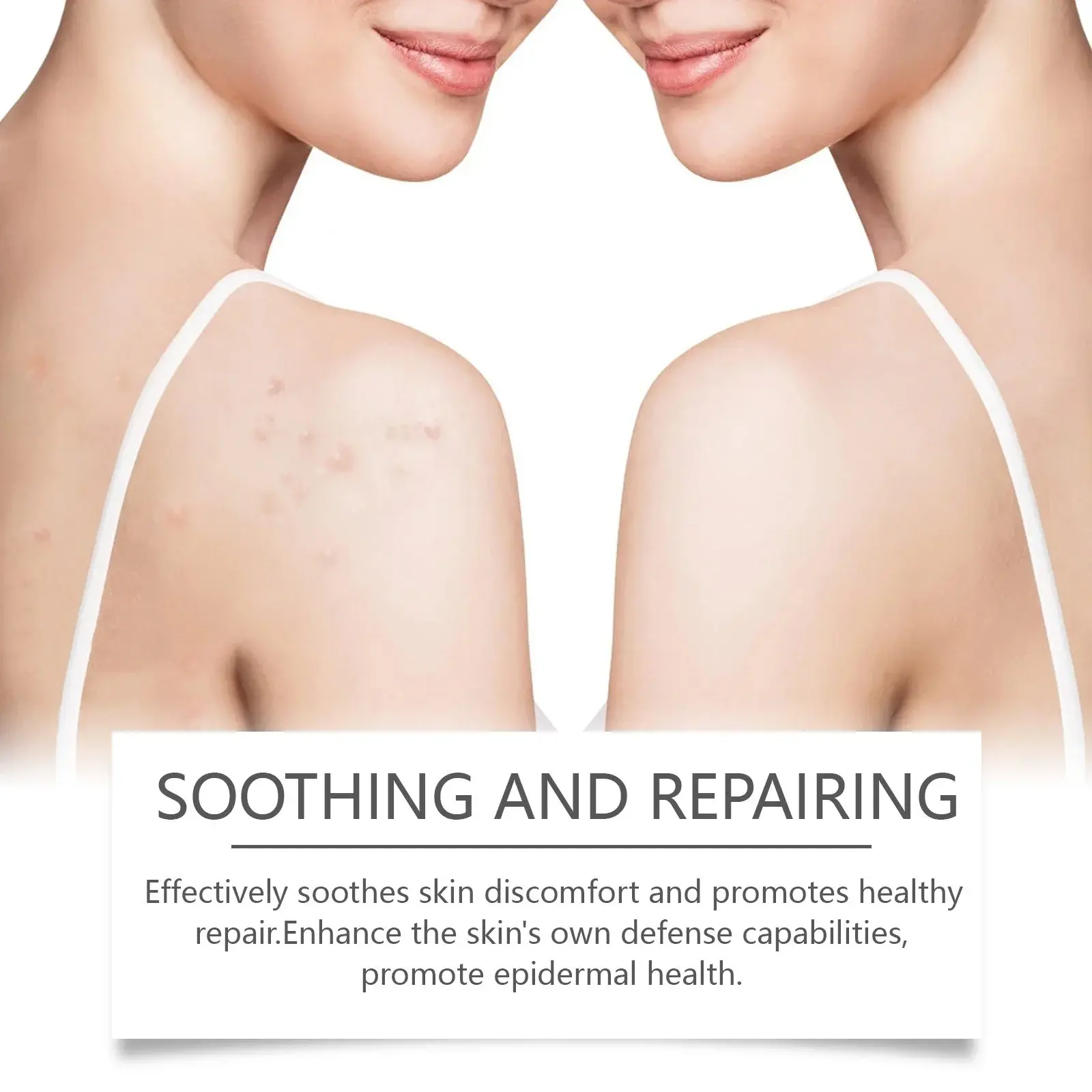 Centella Skin Repair Cream with Plant Extracts for a Healthy Glow 6 HOA05 A173 50 WH1 006