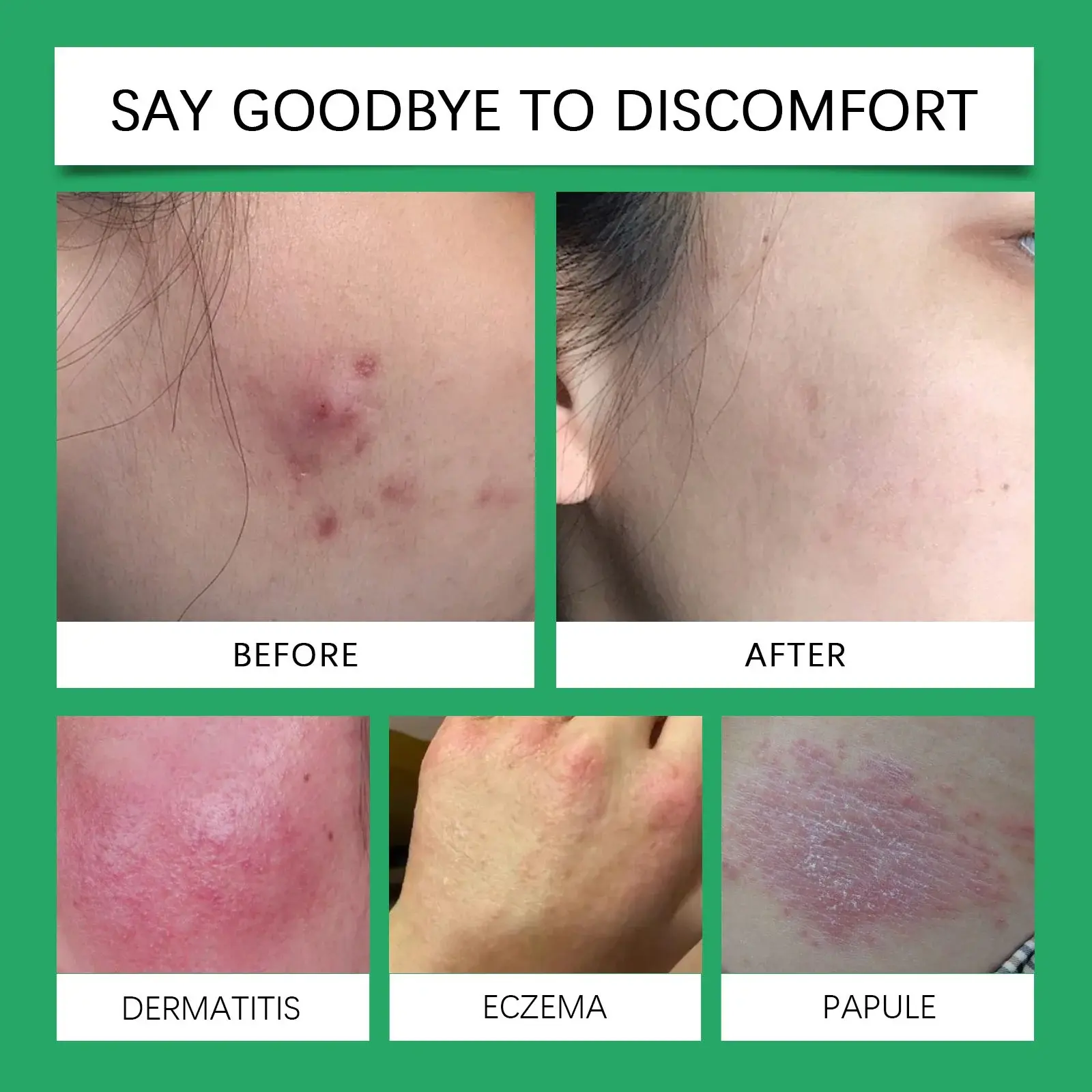 Centella Skin Repair Cream with Plant Extracts for a Healthy Glow 9 HOA05 A173 50 WH1 009