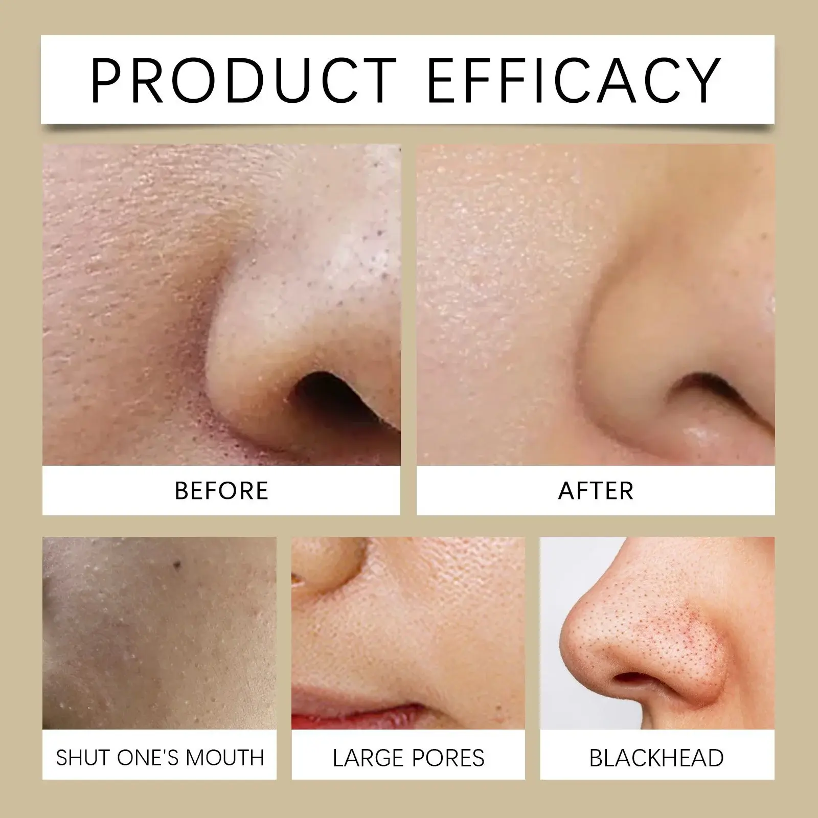 Blackhead Peel Mask for Pore Cleansing & Hydrating - Hoygi 9 HOA05 A176 60 BK1 009