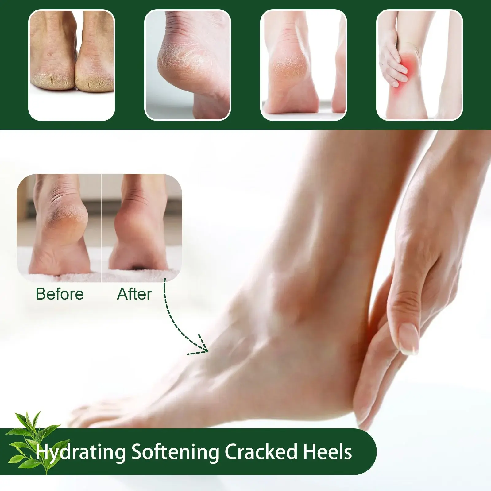 Tea Tree Oil Foot Cream for Cracked Heels & Dry Skin 6 HOA06 A001 50 GN1 1012