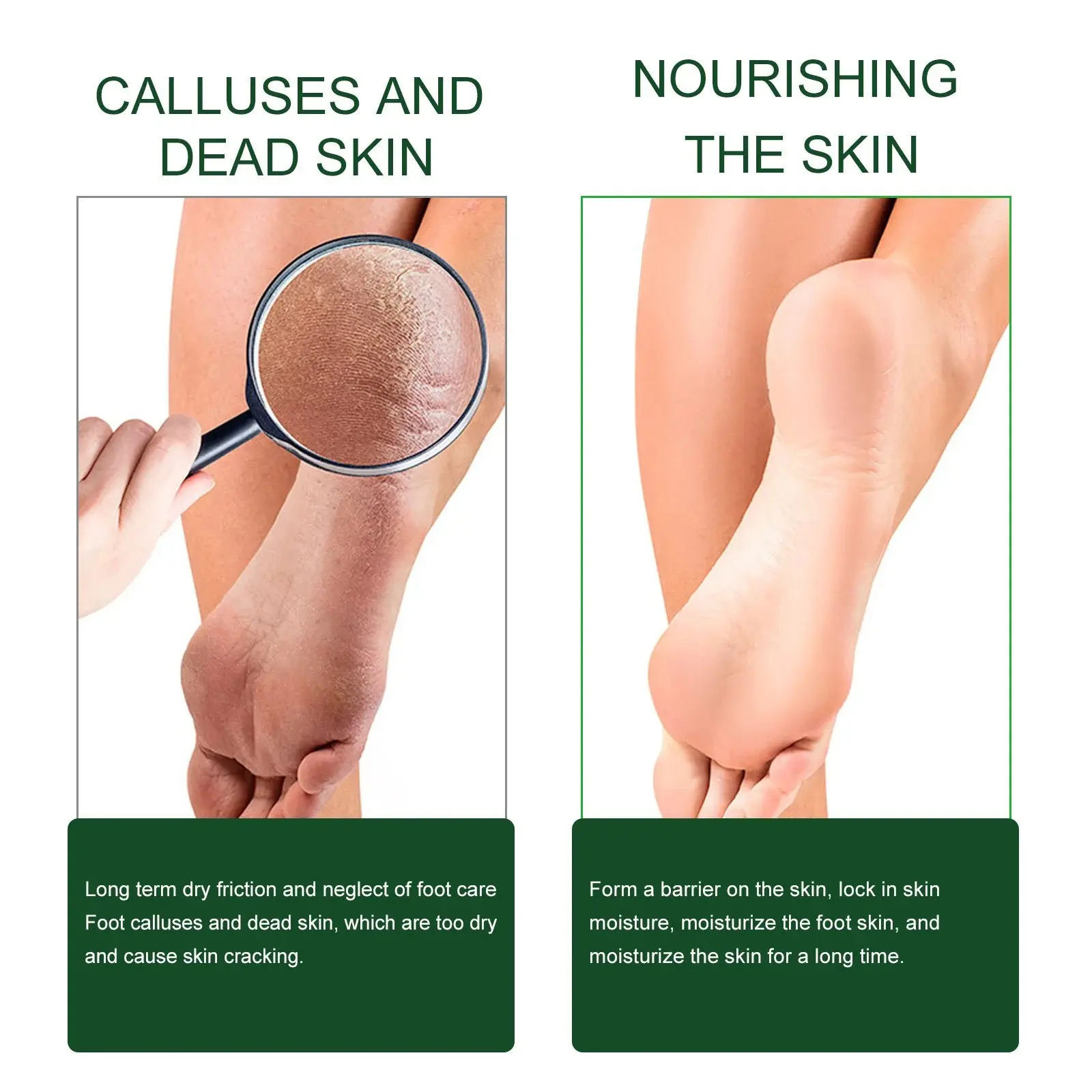 Tea Tree Oil Foot Cream for Cracked Heels & Dry Skin 8 HOA06 A001 50 GN1 1013