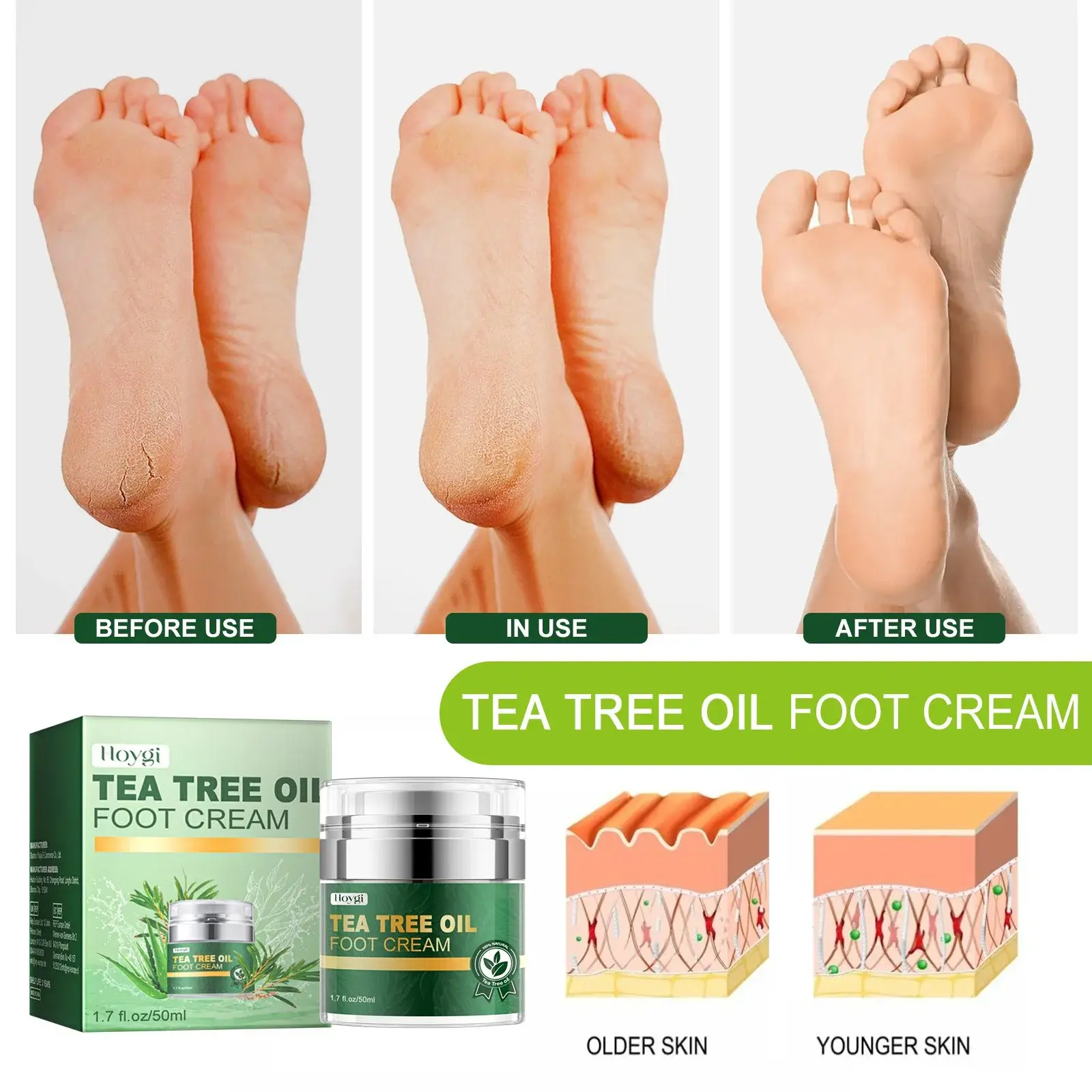 Tea Tree Oil Foot Cream for Cracked Heels & Dry Skin 9 HOA06 A001 50 GN1 1016