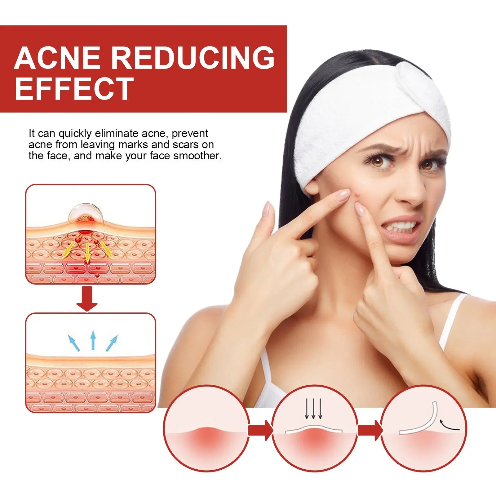 Cute Pimple Patches for Acne Care & Skin Support 5 HOB07 A001 249 RD1 006
