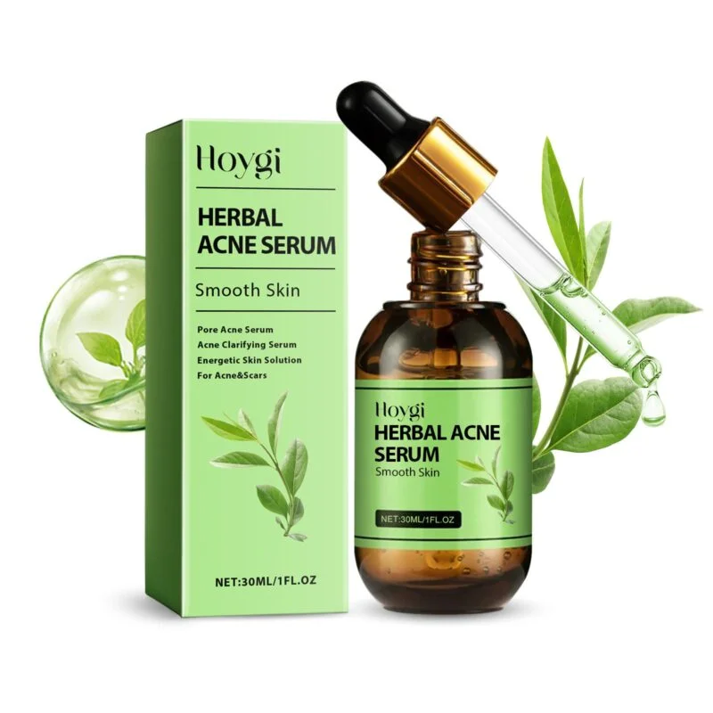 Hoygi Herbal Acne Serum - Reduce Pimples & Moisturize Skin