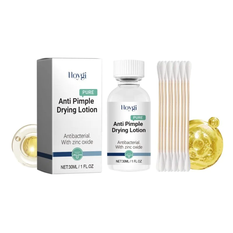 Hoygi Anti-Pimple Drying Lotion for Lightening Acne Marks and Pits